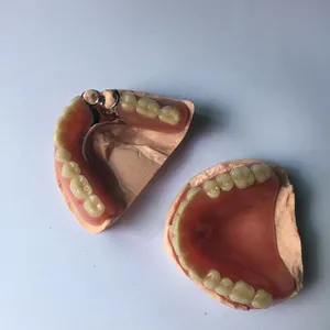 Cast partial – case by Well Dental Lab (3)