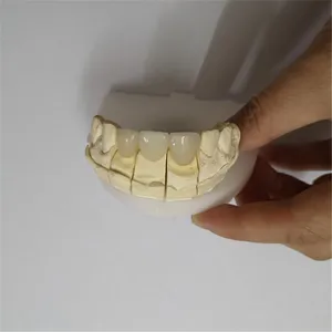 Emax bridge – case by Well Dental Lab