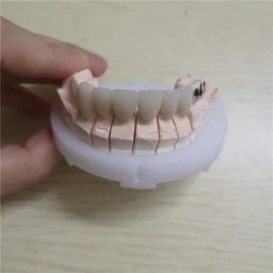 Emax crown – case by Well Dental Lab (3)