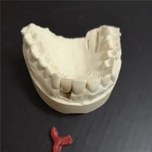 Emax implant crown – case by Well Dental Lab