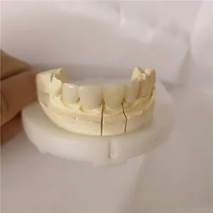 Emax veneer and crown – case by Well Dental Lab