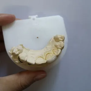 Emax veneer – case by Well Dental Lab (4)