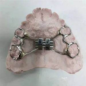 Fixed platal expander – case by Well Dental Lab