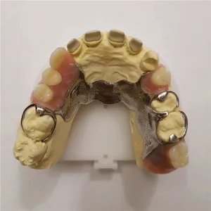 Co-Cr post with op – case by Well Dental Lab