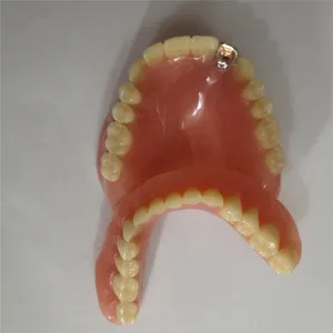 Dentures with gold crown – case by Well Dental Lab