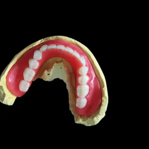 Full lower denture try in – case by Well Dental Lab