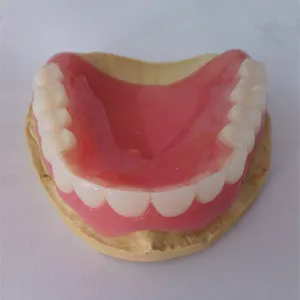 Full upper denture – case by Well Dental Lab
