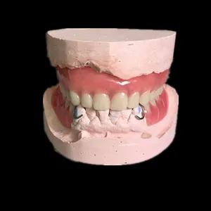 Full&partial dentures – case by Well Dental Lab