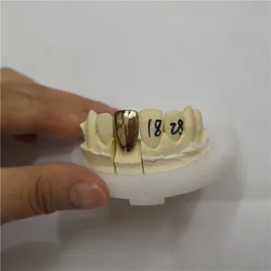 Gold crown – case by Well Dental Lab (2)