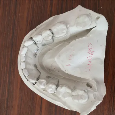 Hawley retainer – case by Well Dental Lab