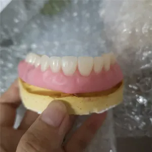 Implant attachment denture try in – case by Well Dental Lab