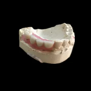 PFM implant crown – case by Well Dental Lab