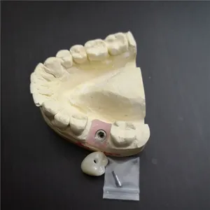 Full zirconia implant  crown – case by Well Dental Lab