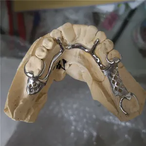 Metal framework – case by Well Dental Lab (4)