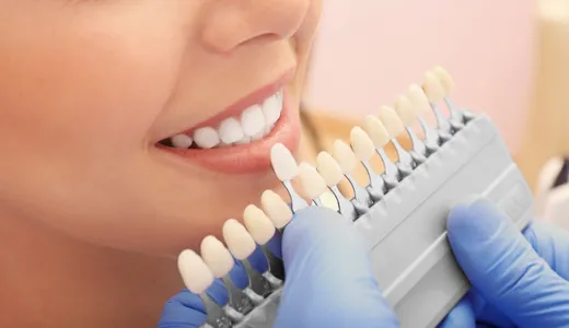 Dentist selecting a shade tab next to a patient's teeth
