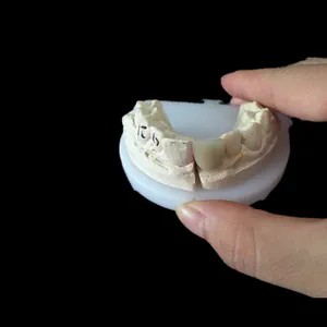 PFM – case by Well Dental Lab (2)