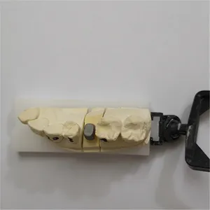 Post core – case by Well Dental Lab (2)