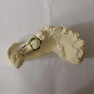 Space maintainer with distal shoe – case by Well Dental Lab