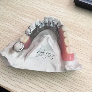 Titanium framework – case by Well Dental Lab