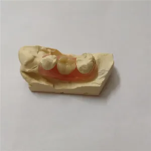Valplast(nesbit) – case by Well Dental Lab