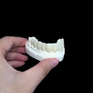 Veneer – case by Well Dental Lab