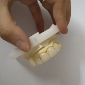 Emax veneer – case by Well Dental Lab (3)