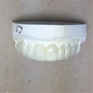 Veneer – case by Well Dental Lab (2)