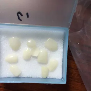 Veneer – case by Well Dental Lab (3)