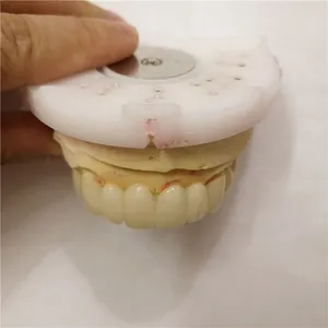 Zirconia bridge – case by Well Dental Lab (2)