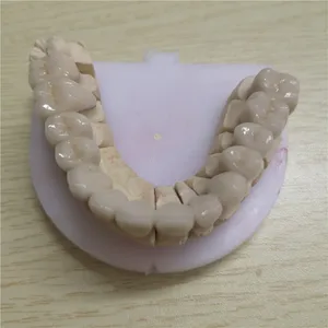 Zirconia bridge – case by Well Dental Lab (3)