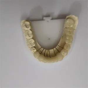 Zirconia bridge – case by Well Dental Lab