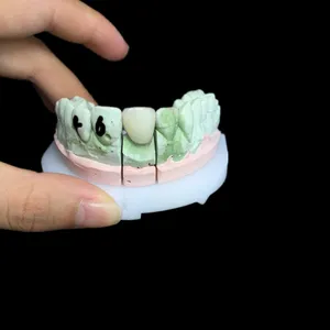 Zirconia crown – case by Well Dental Lab (2)