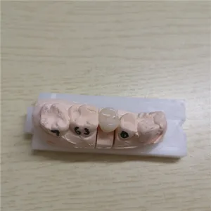 Zirconia crown – case by Well Dental Lab (3)